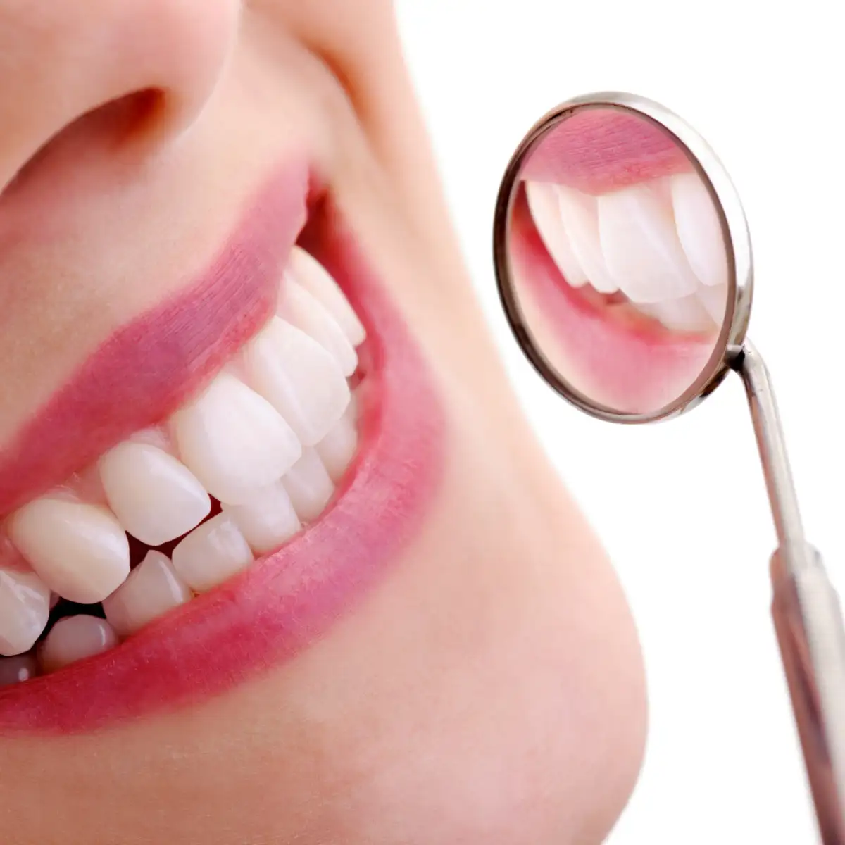 Limpieza Dental Gratis